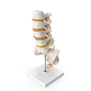 Spinal Column with Hernia on StandG032k - Radiant Chiropractic Canterbury