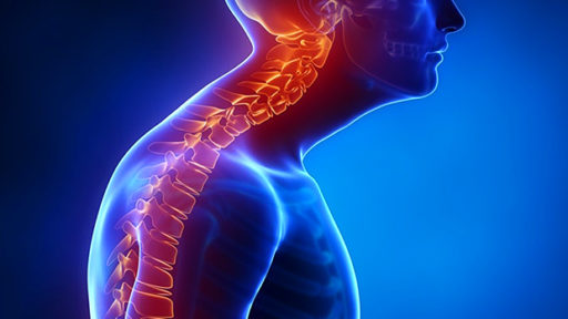 forward-head-posture-512x288 - Radiant Chiropractic Canterbury