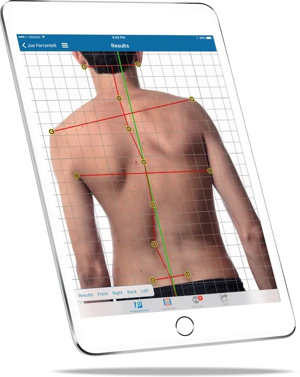 iPad_angle_right_facing_SCOLIOSIS_on_PostureScreenApp_600w - Radiant Chiropractic Canterbury