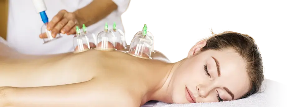 Back Cupping Therapy Treatment - Radiant Chiropractic Melbourne Cupping therapy applied to the upper back for muscle tension and pain relief